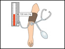 Click to view animation about Measuring Blood Pressure